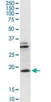 Anti-CD247 Rabbit Polyclonal Antibody