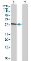 Anti-ZNF414 Mouse Polyclonal Antibody