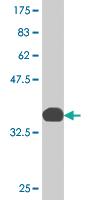 Anti-MARCH6 Mouse Monoclonal Antibody [clone: 1A5]