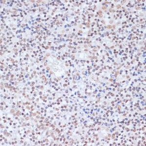 Immunohistochemistry analysis of paraffin-embedded human tonsil using Anti-Histone H1.4 (acetyl Lys26) Antibody (A305416) at a dilution of 1:200 (40X lens). Perform microwave antigen retrieval with 10 mM PBS buffer pH 7.2 before commencing with IHC staining protocol