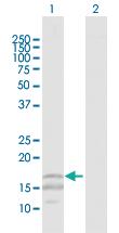 Anti-CD247 Rabbit Polyclonal Antibody