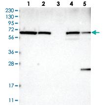 Anti-UBXN4 Rabbit Polyclonal Antibody