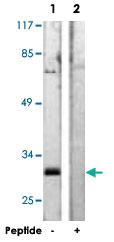 Anti-KCNIP3 Rabbit Polyclonal Antibody