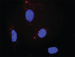 Anti-PTPRR + MAPK1 Antibody Pair