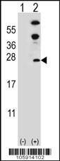 Anti-DUSP14 Rabbit Polyclonal Antibody (HRP (Horseradish Peroxidase))