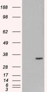 Anti-ORC6L antibody