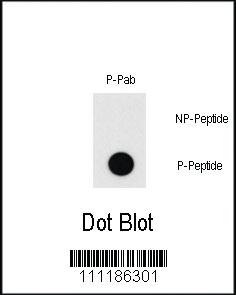 Anti-MEF2C Rabbit Polyclonal Antibody