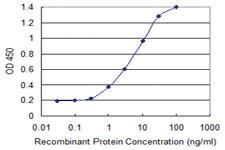 Anti-APCS Mouse Monoclonal Antibody [clone: 4E8]