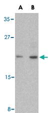 Anti-CASP6 Rabbit Polyclonal Antibody