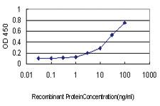 Anti-NLGN4Y Mouse Monoclonal Antibody [clone: 1E4]