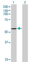 Anti-SUFU Rabbit Polyclonal Antibody