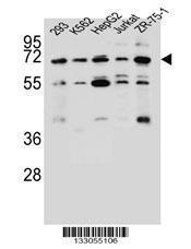 Anti-KCNV2 Rabbit Polyclonal Antibody (Biotin)