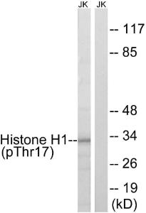 Western blot analysis of lysates from Jurkat cells treated with UV 15' using Anti-Histone H1 (phospho Thr17) Antibody. The right hand lane represents a negative control, where the antibody is blocked by the immunising peptide