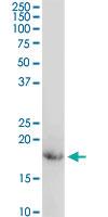 Anti-CD247 Rabbit Polyclonal Antibody