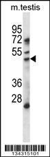 Anti-HDAC11 Rabbit Polyclonal Antibody (AP (Alkaline Phosphatase))