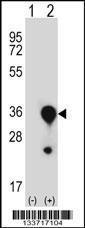 Anti-MBL2 Rabbit Polyclonal Antibody (Biotin)