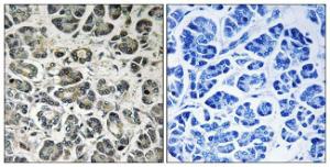 Immunohistochemical analysis of paraffin-embedded human pancreas tissue using Anti-NDUFA8 Antibody. The right hand panel represents a negative control, where the antibody was pre-incubated with the immunising peptide