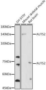 Western blot analysis of extracts of various cell lines, using Anti-AUTS2 Antibody (A306322) at 1:1,000 dilution The secondary antibody was Goat Anti-Rabbit IgG H&L Antibody (HRP) at 1:10,000 dilution Lysates/proteins were present at 25 µg per lane