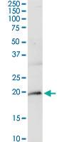 Anti-CD247 Rabbit Polyclonal Antibody