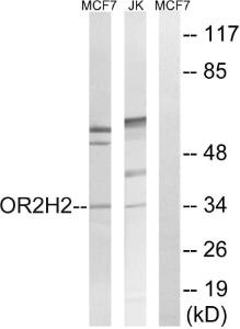 Western blot analysis of lysates from Jurkat and MCF-7 cells using Anti-OR2H2 Antibody The right hand lane represents a negative control, where the antibody is blocked by the immunising peptide