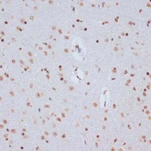 Immunohistochemistry analysis of paraffin-embedded mouse brain using Anti-Histone H1.4 (acetyl Lys26) Antibody (A305416) at a dilution of 1:200 (40X lens). Perform microwave antigen retrieval with 10 mM PBS buffer pH 7.2 before commencing with IHC staining protocol