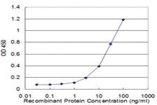 Anti-APCS Mouse Monoclonal Antibody [clone: 4F3]