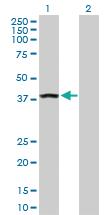 Anti-ANKRA2 Rabbit Polyclonal Antibody