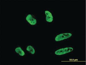 Anti-RNF151 Mouse Monoclonal Antibody [clone: 4G8]