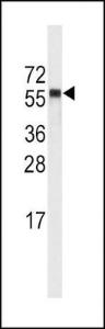 Anti-CYP4A11 Rabbit Polyclonal Antibody