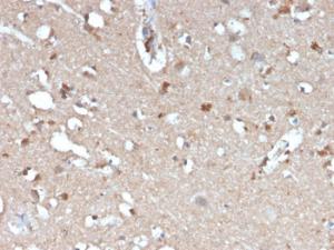 Immunohistochemical analysis of formalin-fixed, paraffin-embedded human brain using Anti-beta Amyloid Antibody [APP/3345]