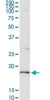 Anti-CD247 Rabbit Polyclonal Antibody