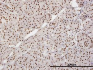 Anti-XRCC5 Mouse Monoclonal Antibody [clone: 3D8]