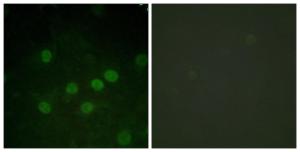 Immunofluorescence analysis of HUVEC cells, treated with serum 20% 30', using Anti-Histone H1 (phospho Thr17) Antibody. The right hand panel represents a negative control, where the antibody was pre-incubated with the immunising peptide