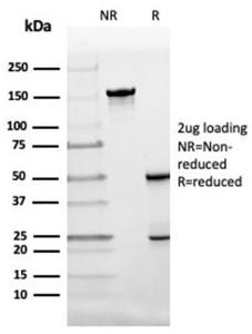 Antibody anti-FABP4 FABP44424 100 µg