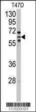 Anti-CYP2C8 Rabbit Polyclonal Antibody