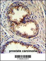 Anti-GOLPH3 Rabbit polyclonal antibody