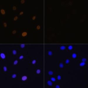 Immunofluorescence analysis of C6 cells using Anti-Histone H1.4 (acetyl Lys26) Antibody (A305416) at a dilution of 1:100. DAPI was used to stain the cell nuclei (blue). C6 cells were treated by TSA (1 uM) at 37 °C for 18 hours. DAPI was used to stain the cell nuclei (blue)