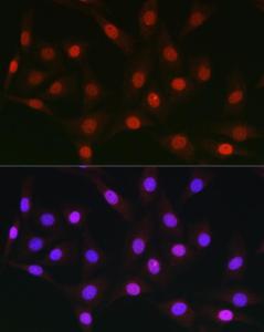 Immunofluorescence analysis of NIH/3T3 cells using Anti-AUTS2 Antibody (A306322) at a dilution of 1:50 (40x lens) DAPI was used to stain the cell nuclei (blue)