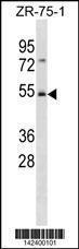 Anti-FBXW4 Rabbit Polyclonal Antibody