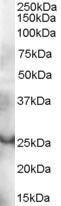 Anti-GRAP Antibody (A83771) (03 µg/ml) staining of human thymus lysate (35 µg protein in RIPA buffer) Primary incubation was 1 hour Detected by chemiluminescence