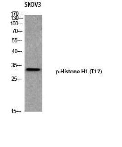 Western blot analysis of SKOV3 using Anti-Histone H1 (phospho Thr17) Antibody