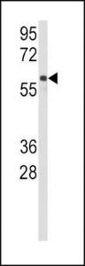 Anti-CYP2C9 Rabbit Polyclonal Antibody