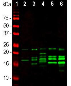 Western blot analysis of different tissue lysates