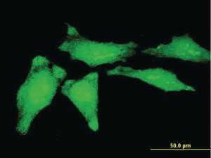 Anti-YBX1 Mouse Monoclonal Antibody [clone: 4C7]