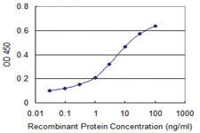 Anti-SUFU Mouse Monoclonal Antibody [clone: 1B2]