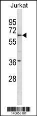 Anti-FBXW5 Rabbit Polyclonal Antibody (APC (Allophycocyanin))