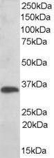 Anti-TMX1 Antibody (A83772) (0.01 µg/ml) staining of Human Liver lysate (35 µg protein in RIPA buffer). Primary incubation was 1 hour. Detected by chemilu minescence