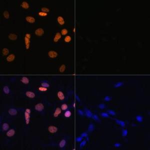 Immunofluorescence analysis of NIH/3T3 cells using Anti-Histone H1.4 (acetyl Lys26) Antibody (A305416) at a dilution of 1:100. DAPI was used to stain the cell nuclei (blue). NIH/3T3 cells were treated by TSA (1 uM) at 37 °C for 18 hours. DAPI was used to stain the cell nuclei (blue)