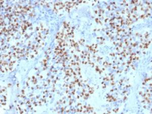 Immunohistochemical analysis of formalin-fixed, paraffin-embedded human lymph node using Anti-OCT-2 Antibody [Oct2/2136]