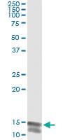 Anti-NLGN4Y Mouse Monoclonal Antibody [clone: 2F7]